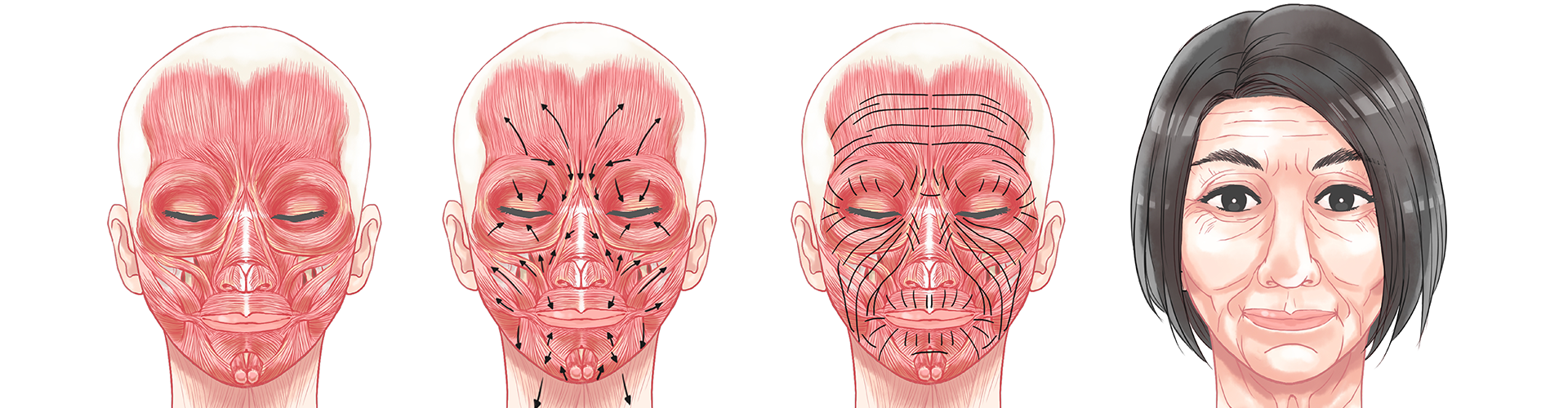 Injection Anatomy-Introductory