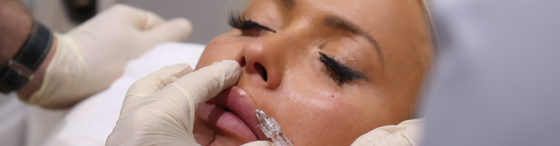 Dermal Fillers-Introductory