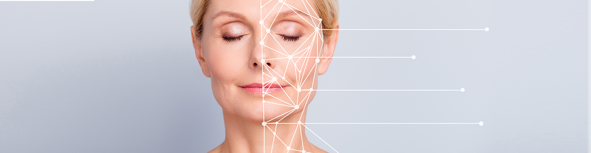 8-point Facelift with STYLAGE-Introductory