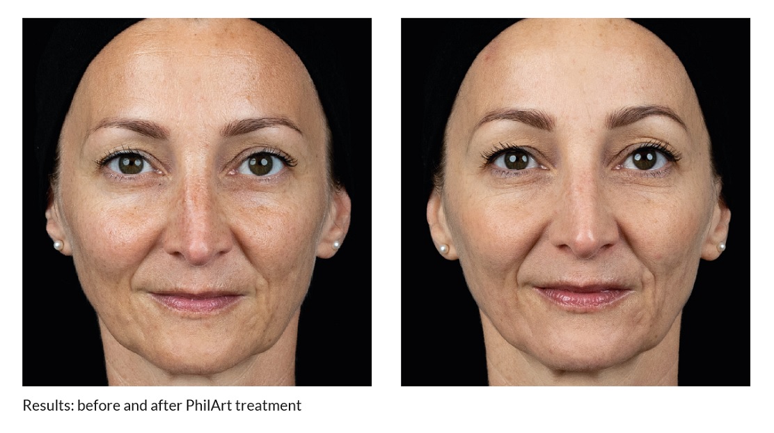 New Croma PhilArt and PhilArt eye Wigmore Medical